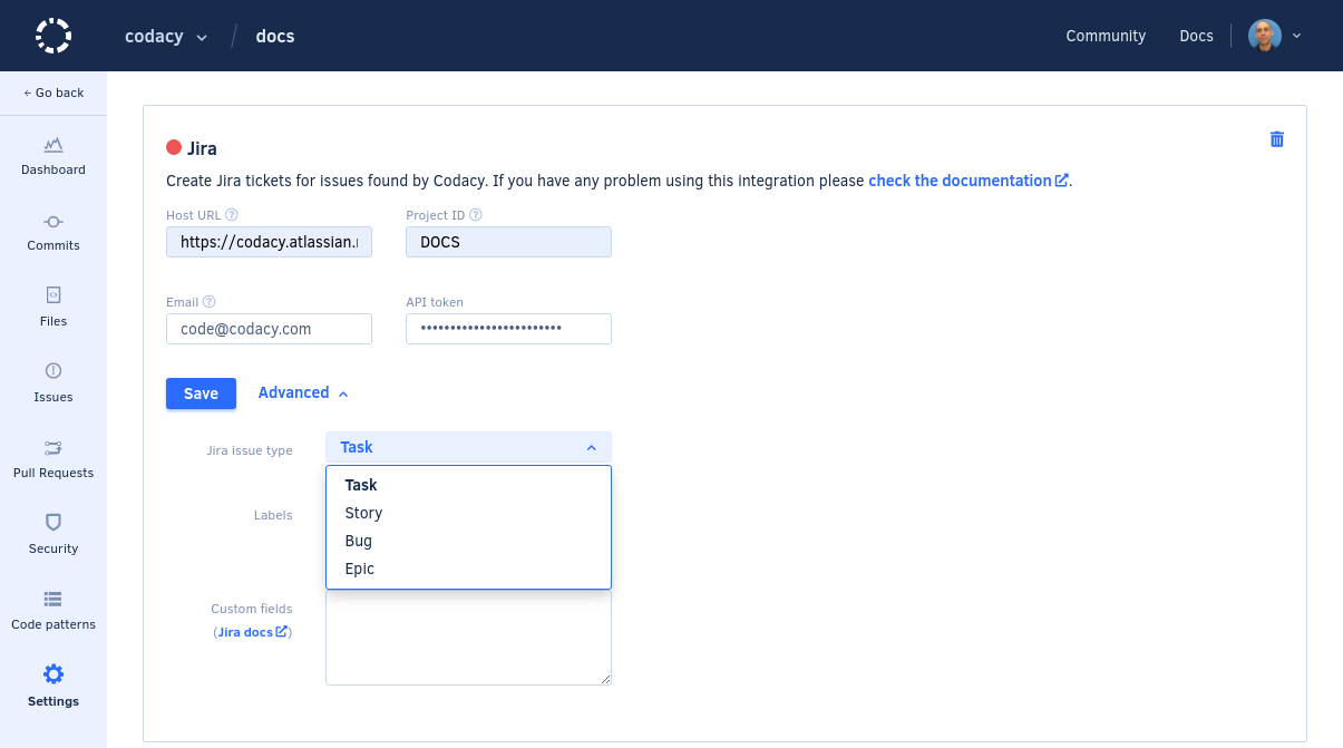 Advanced settings of the Jira integration